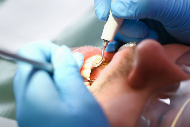 Best Walk-In Emergency Dentist in Avilla, AR