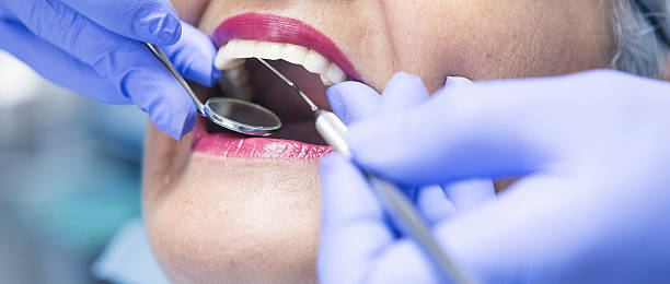 Best Emergency Broken Tooth Repair in Avilla, AR